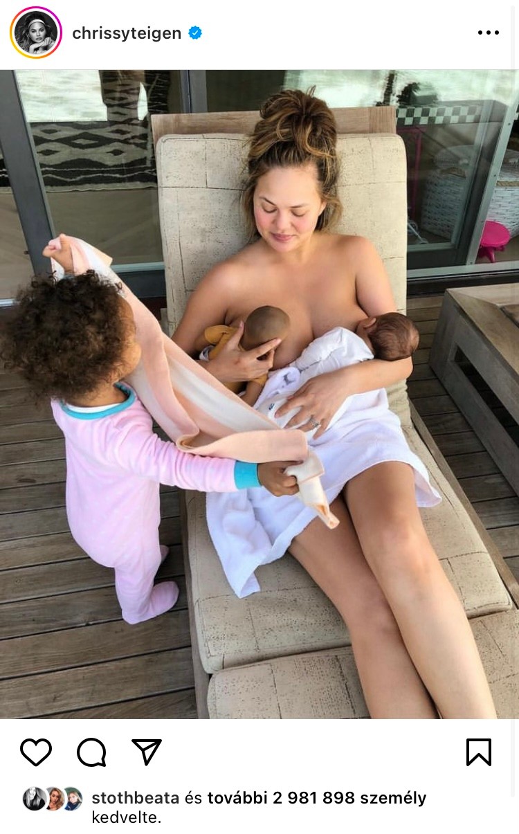 Chrissy Teigen