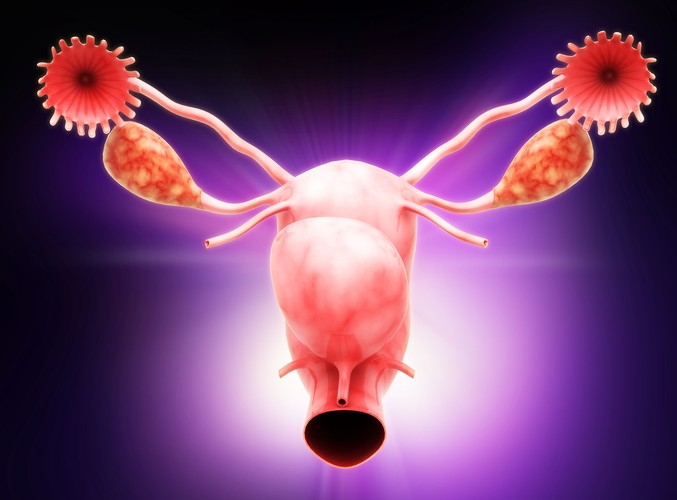 Mięśniak macicy to łagodny nowotwór?