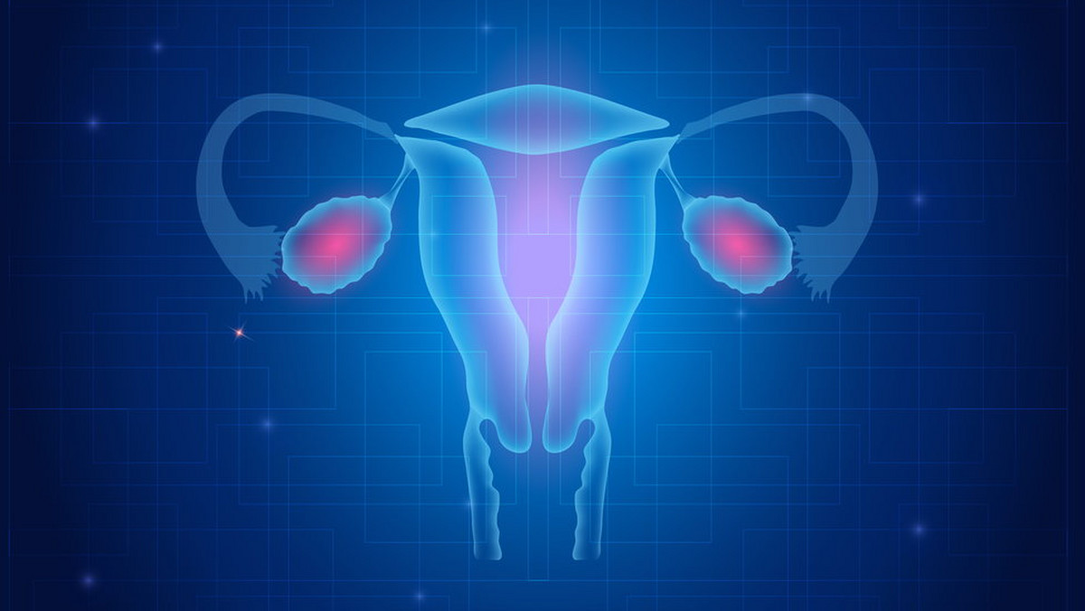Rak jajnika jest nowotworem złośliwym dotykającym kobiety głównie w okresie menopauzy i po menopauzie. W początkowych fazach jest nowotworem niedającym żadnych objawów, co utrudnia jego leczenie w późniejszych etapach choroby. Zwykle objawy raka jajnika na etapie średniozaawansowanym bywają bagatelizowane, gdyż nie należą do charakterystycznych. Skutkuje to zbyt późnym rozpoznaniem owej choroby (najczęściej w III lub IV stadium), co znacząco zmniejsza szansę na jej wyleczenie. Rak jajnika plasuje się na czwartym miejscu wśród nowotworów, na które umierają kobiety.