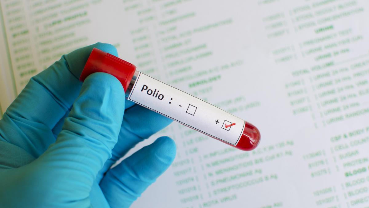 polio pozytywne wyniki badań choroba