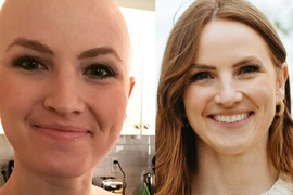 Ja sam doktorka i POBEDILA SAM RAK U 3. FAZI: Jedite OVE 2 NAMIRNICE i izbegavajte OVU VRSTU PIĆA da sprečite razvoj kancera