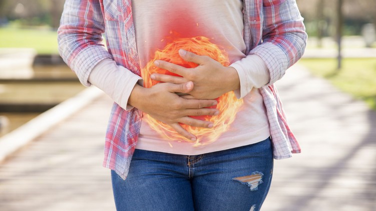 Reflux puffadás gyomorsav gyomorégés ellen praktikák