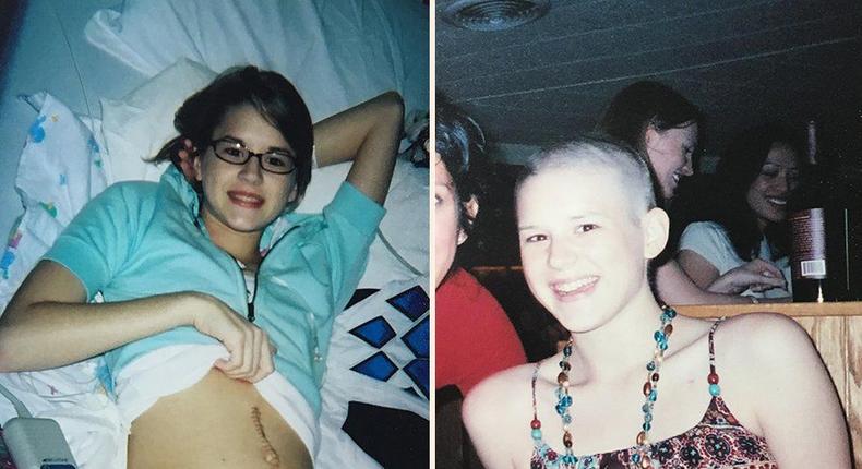 I Was Diagnosed With Ovarian Cancer When I Was 17