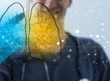 Történelmi mérföldkő a hazai pulmonológiában című cikk nyitóképe