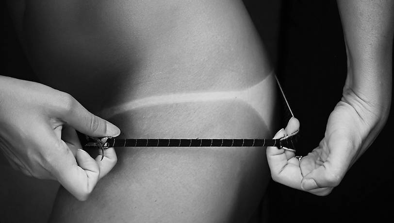 Sonnenbrand: Diese After-Sun-Lösungen helfen