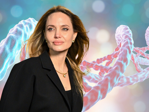 Angelina Jolie egy DNS-vizsgálat miatt vetette le a melleit, de a szakember szerint ne rohanjunk egyből teszteltetni