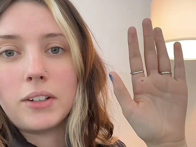 Veštačka inteligencija joj spasila život nakon što joj je zatražila da joj čita sudbinu s dlana