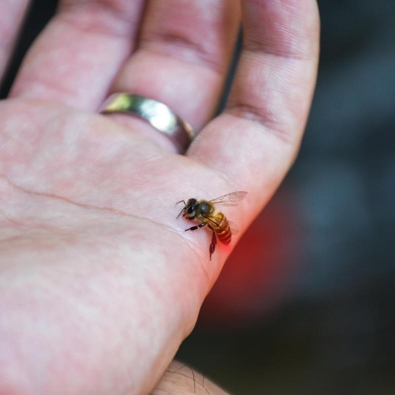 Uzadlenia Szerszenia Pszczoly Osy Trzmiela Jak Postepowac Po Ukaszeniu