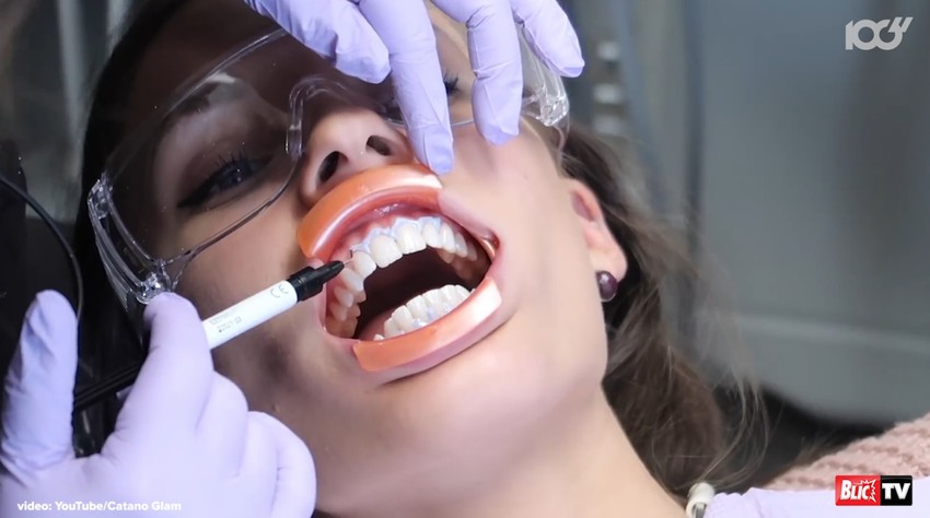 Sređivanje zuba i pet puta jeftinije