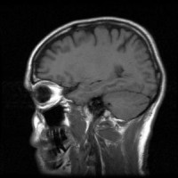 mri-agy-d00000E8844bb9ec3a81b