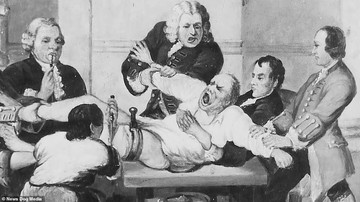 Ez a kép azt mutatja, hogyan nézett ki egy amputáció a 19. század elején. 1846-ig nem alkalmaztak érzéstelenítőt, ezért sok asszisztensre volt szükség ahhoz, hogy lefogják a pácienst, miközben a saját végtagját nézték. Ez a folyamat gyötrelmes lett volna, így akik megengedhették maguknak, azokhoz a sebészekhez mentek, akik a leggyorsabban tudták eltávolítani a végtagot.