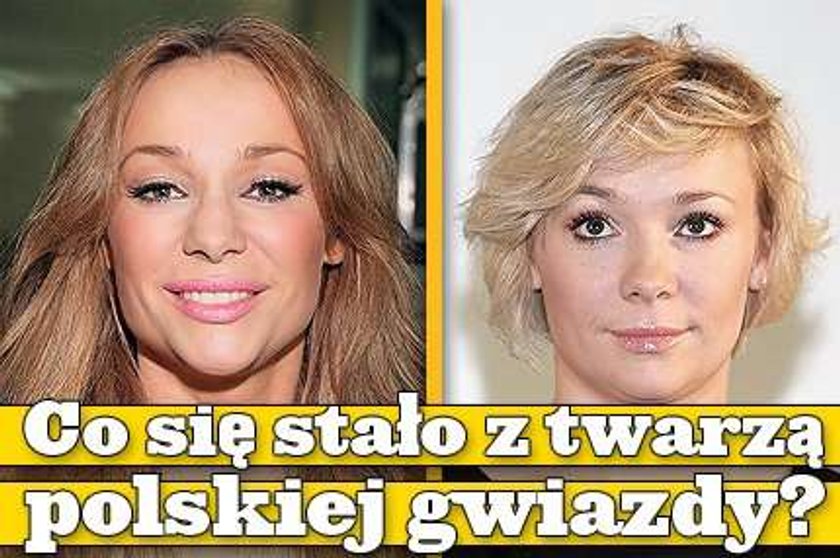 Co się stało z twarzą polskiej gwiazdy?