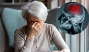 Cztery mało znane objawy udaru mózgu u kobiet. Są inne niż u mężczyzn