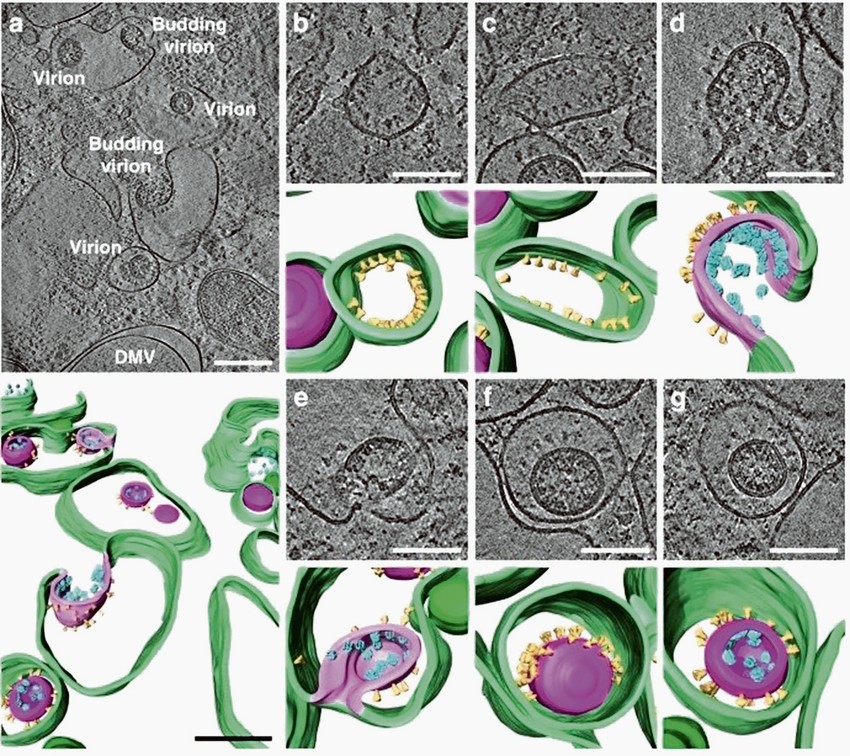 Virus: Zeleno su membrane unutar zaražene ćelije, ljubičasto virusna membrana, a žuto već čuveni šiljak protein virusa korona. A smutljivci kažu da ne postoji...