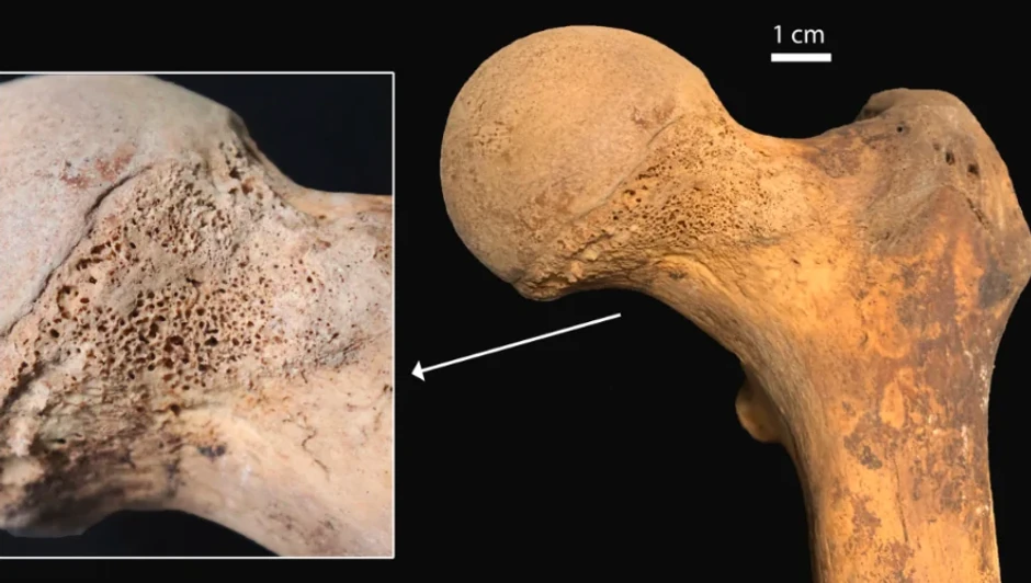 Tragovi kanabisa na femuru
