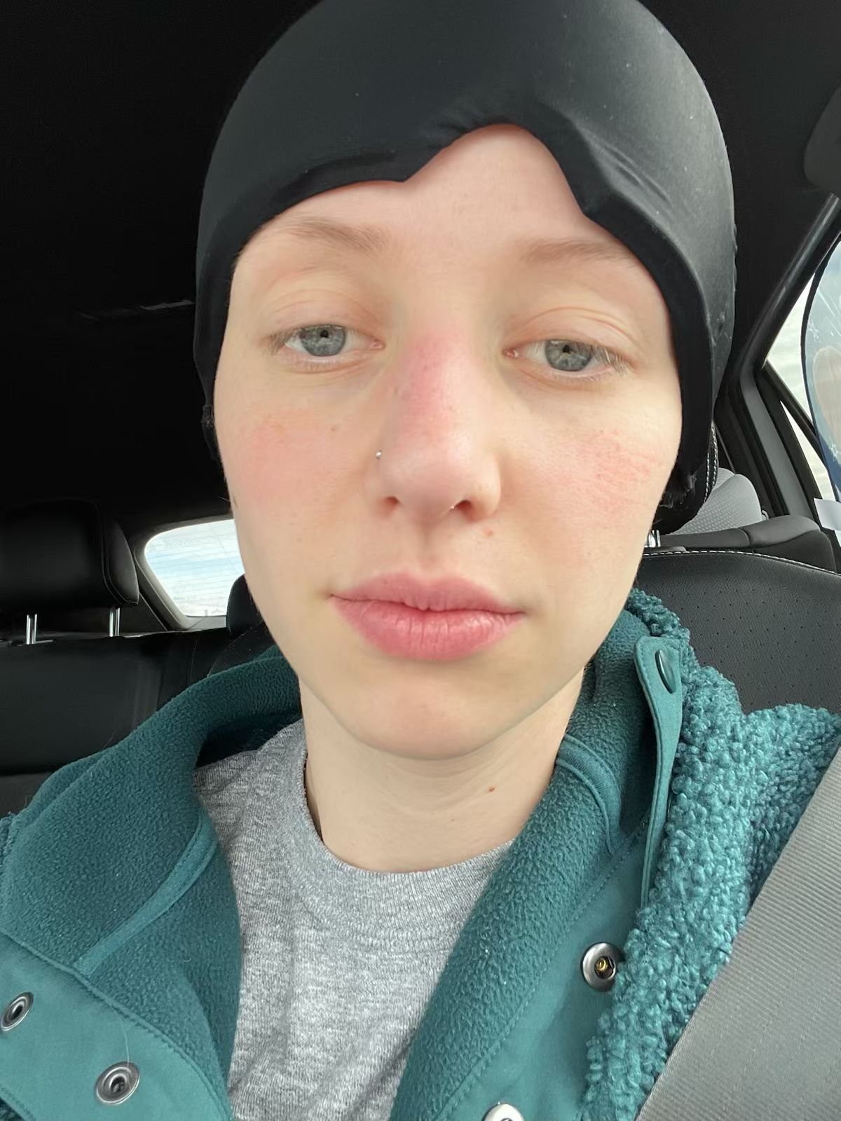 Kelsey diagnostikovali agresívnu rakovinu.