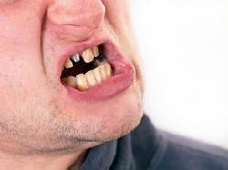 To obrzydza kobiety w wyglądzie mężczyzn. TOP 5!