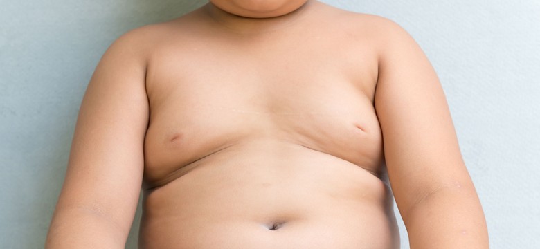 Nadmierna otyłość u dzieci prowadzi do zmian w ich mózgach