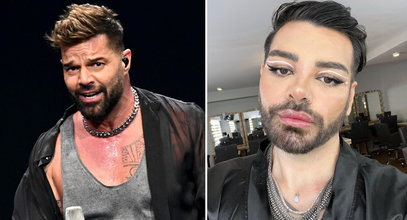 Chciał wyglądać jak Ricky Martin. Przeszedł 30 operacji plastycznych, ale coś nie wyszło...