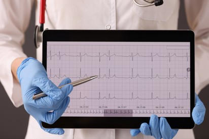 Szívritmuszavar: így ismerhető fel a tünetek alapján