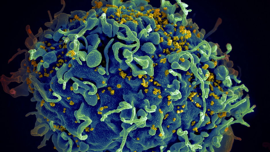 Najsłynniejszy z retrowirusów, HIV – żółte punkty – infekujący ludzką komórkę
