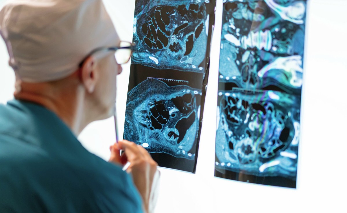 Sztuczna inteligencja nieporównywalnie lepsza niż lekarz. Zaskakujące wyniki badań w USA