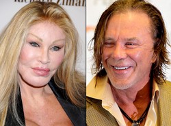 Zobacz, jak oszpeciły ich operacje plastyczne