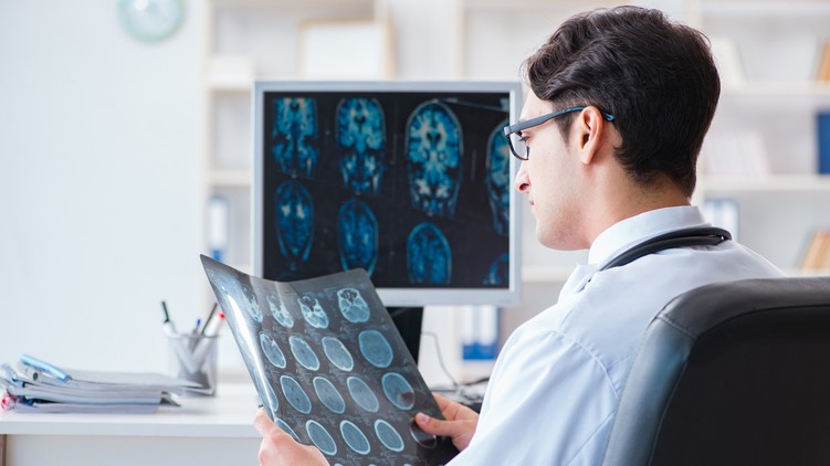 PTE új diagnosztikai műtéti eljárás epilepszia kezelés