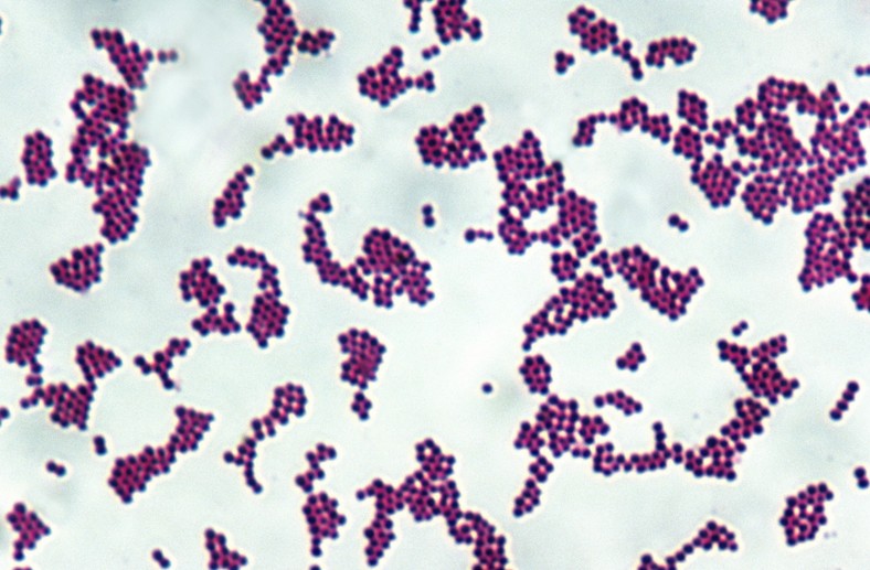 Gronkowiec złocisty - Staphylococcus aureus