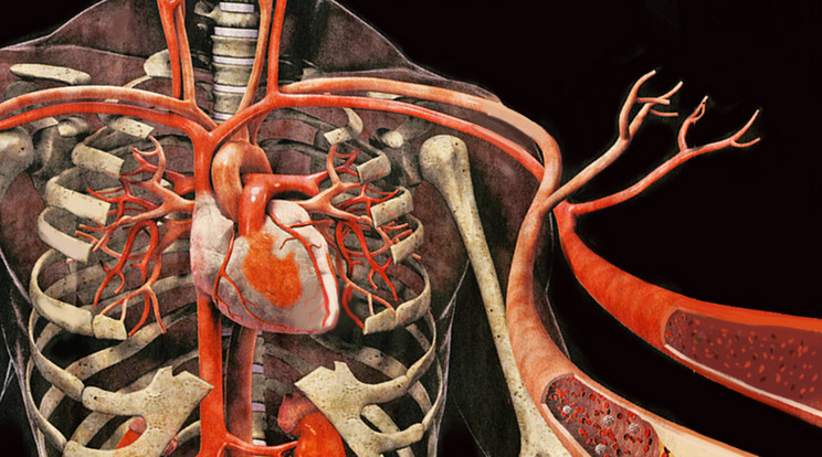 A vérnyomás a szív pumpáló mozgása során keletkezik. Ha a szív(1.) összehúzódik, akkor vért pumpál az artériákba (2.). Ha túl magas a nyomás, akkor sérülnek a vérerek. Ennek szűkületek, mészlerakódás (3.) a következménye. Ezáltal nő a szívinfarktus vagy az agyvérzés rizikója.