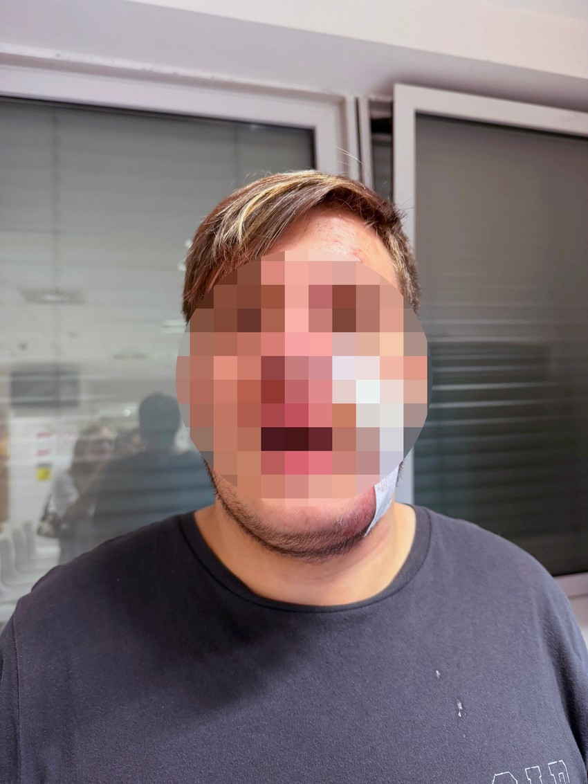 Pretučen tinejdžer 