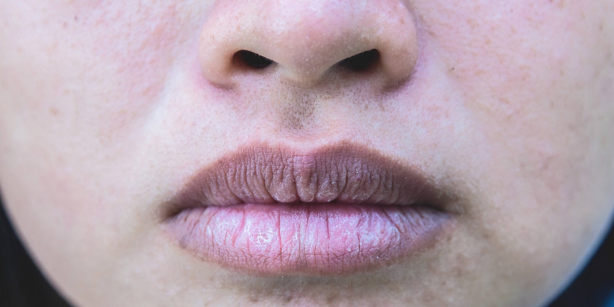 Das verraten Ihre Lippen über Ihre Gesundheit | Vayamo