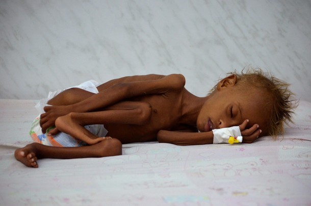 The Wider Image: Risk of famine looms in Yemen 