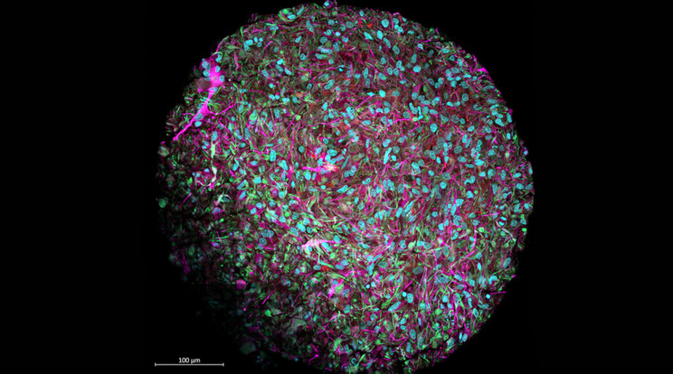 Ebből a gombócból indulnak ki a jövő nagyteljesítményű számítógépei. A Thomas Hartung laboratóriumában előállított agyi organoid (emberi sejtekből épített szervecske) nagyított képén az idegsejtek magenta színnel, a sejtmagok kék színnel, az egyéb támogató sejtek pedig piros és zöld színnel különböztethetők meg. / Fotó: Jesse Plotkin/Johns Hopkins Egyetem