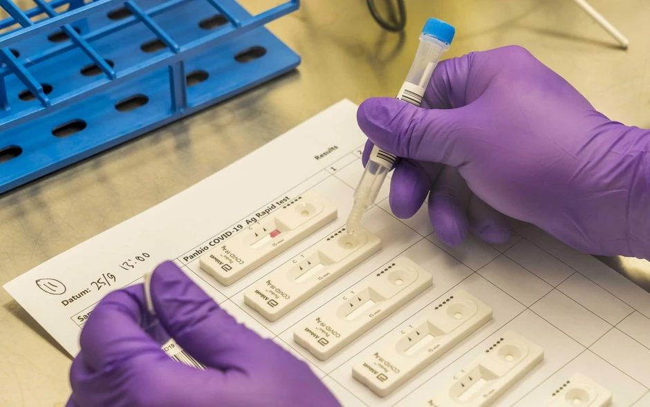 Kon: "Mi smo jedina zemlja na svetu gde se korona brojke posmatrju sa nivoa nekakve "teorije zavere", gde se misli da neko nešto krije smišljeno"