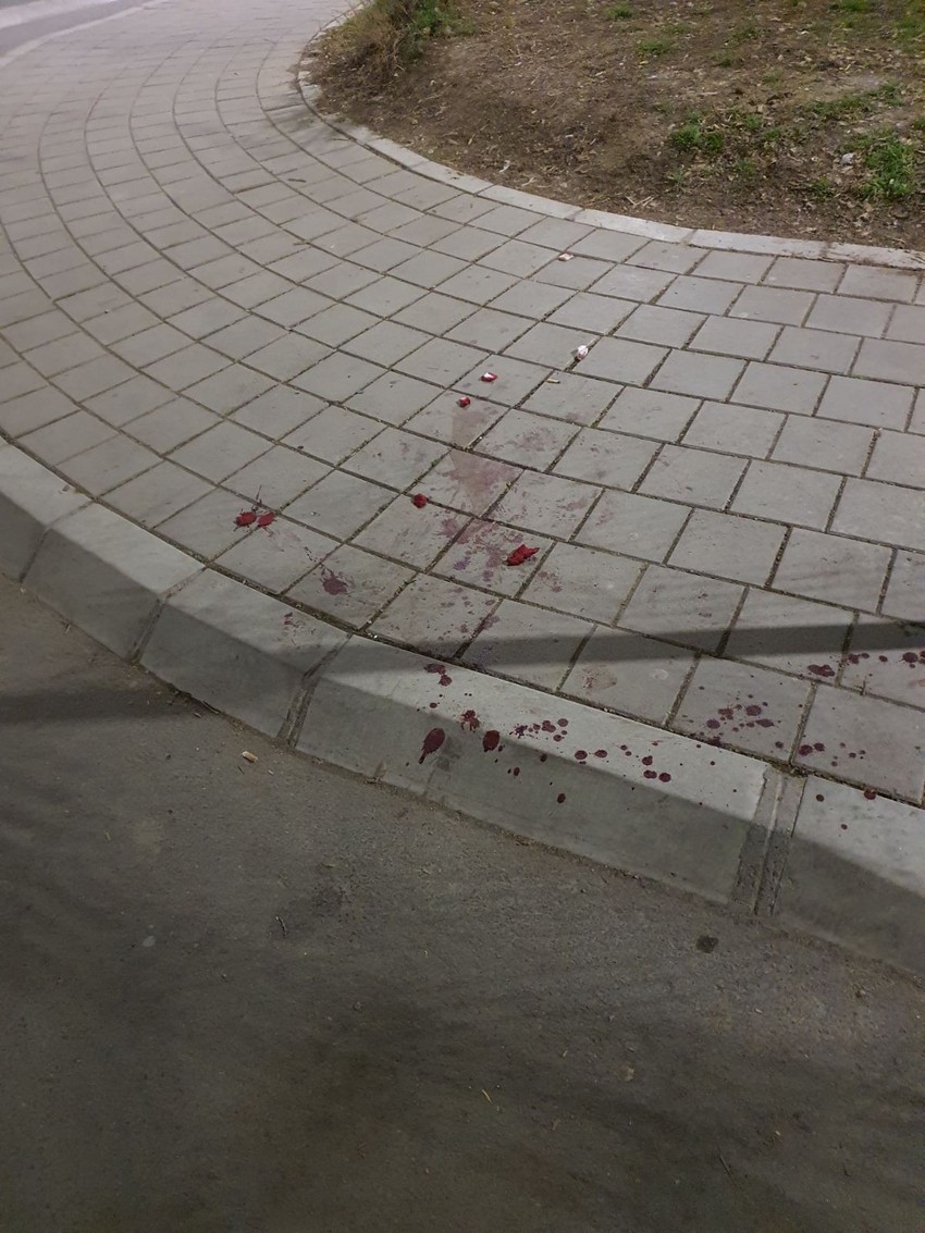 Prerezao vrat muškarcu zbog parking mesta