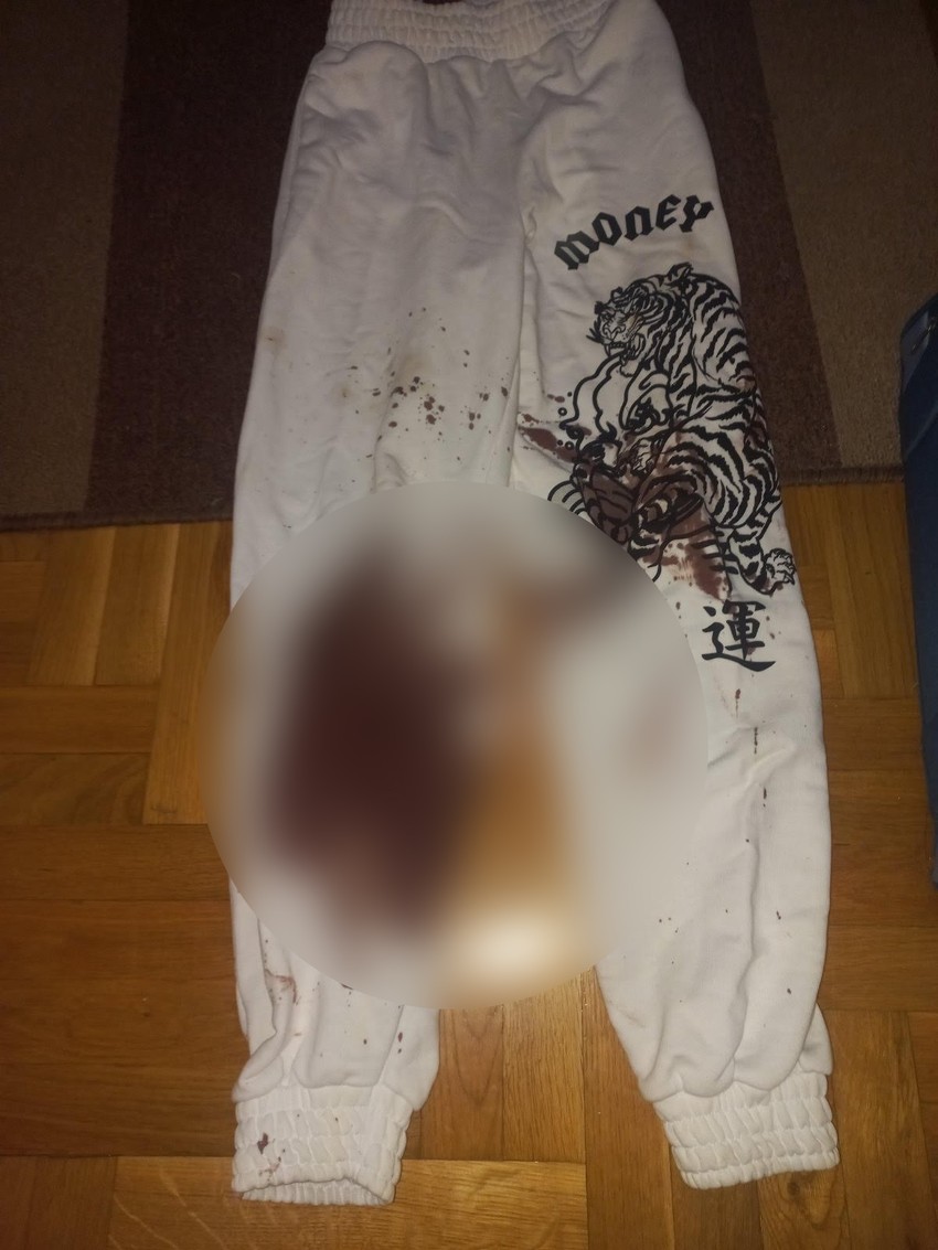 Daničina krvava trenerka