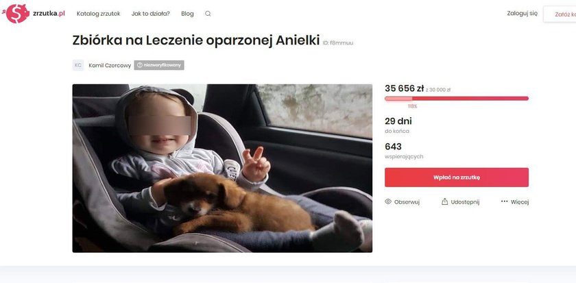 Zbiórka dla poparzonej dziewczynki z Leżachowa