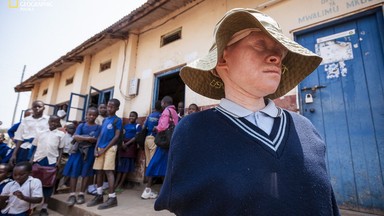 Ludzie duchy. Jak bielactwo determinuje życie w Tanzanii [ZDJĘCIA]