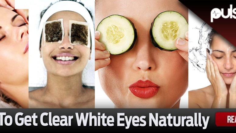 How To Get Clear White Eyes Naturally Pulse Nigeria