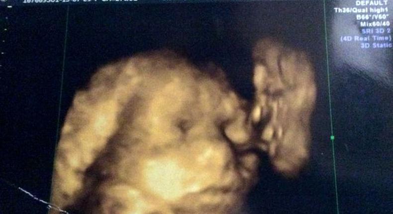 4D scan: Lacey-Mae seen with the 'face of her grandfather' Jack