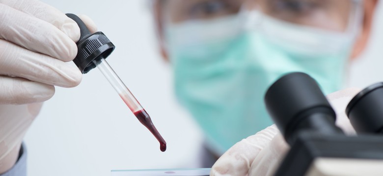 Morfologia pozwala wykryć nowotwór krwi we wczesnym stadium. OBJAWY raka