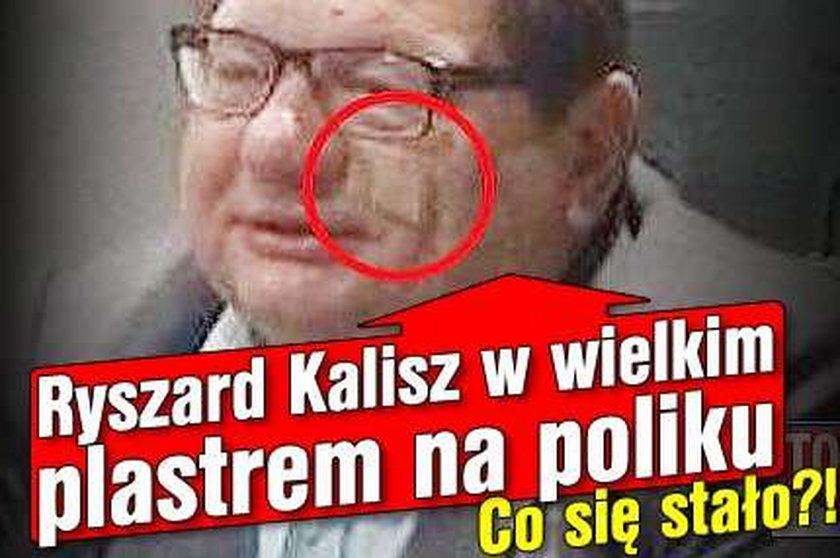 Ryszard Kalisz z wielkim plastrem na poliku. Co się stało?!