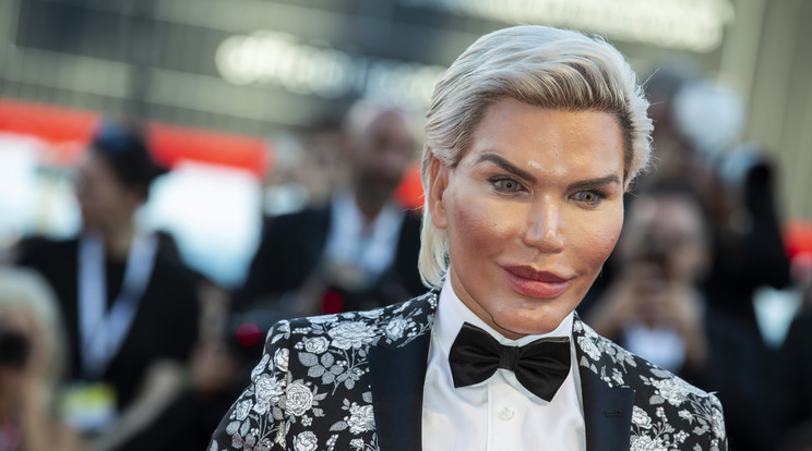 Esedékessé vált egy újabb műtét az élő Ken baba, vagyis Rodrigo Alves számára /Fotó: Northfoto