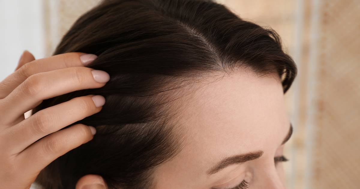 Ta wcierka działa na włosy jak biotynowy zastrzyk. To paliwo na porost baby hair!