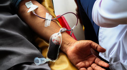 Polscy lekarze zaniepokojeni sytuacją w Ukrainie. Apelują o oddawanie krwi