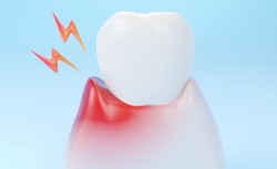 Dziąsła zdradzają, co nam dolega. Jak o nie dbać, by były zdrowe?