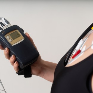 Mi a Holter-monitorozás és mit mutat ki?