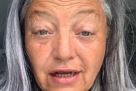 Uložila je čak 12.000 EVRA da PROMENI LIČNI OPIS i sad izgleda KAO DA JE SEBI ĆERKA: Turski hirurzi izveli NIZ ZAHVATA, a nakon transformacije unuci je jedva prepoznali