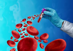 Aplastična anemija nastaje kada koštana srž ne može da proizvede dovoljno krvnih zrnaca